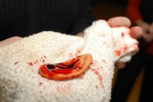 Пасажири зґвалтували жінку-таксиста і відкусили їй вухо