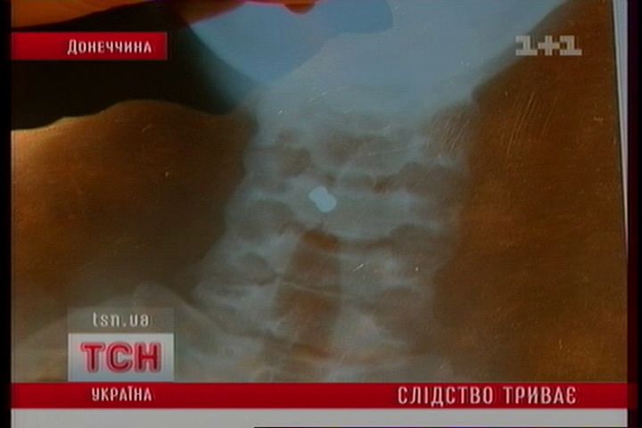 ТСН_2