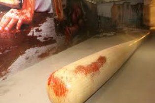 Мужчина проломил жене и сыну головы битой и бросился под поезд