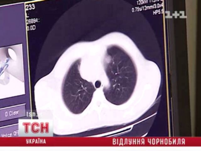10_cancer