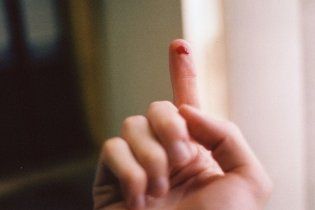 У дитсадку вихователька відірвала дитині палець