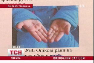 На Днепропетровщине опекунша пытала приемную дочь каленым железом