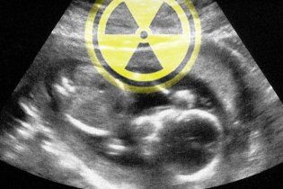 Чернобыльскую радиацию обнаружили в позвонках еще не родившихся детей