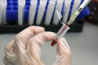 Вчені навчилися передбачати смерть людини за аналізом крові