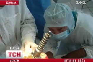 Донецькі хірурги поставили пацієнта на ноги, зробивши йому стегно з титану