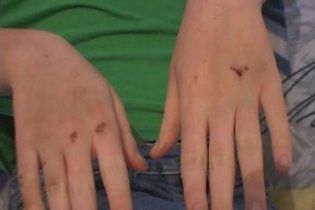 На Луганщині підлітки-садисти роздягли і жорстоко побили однокласницю