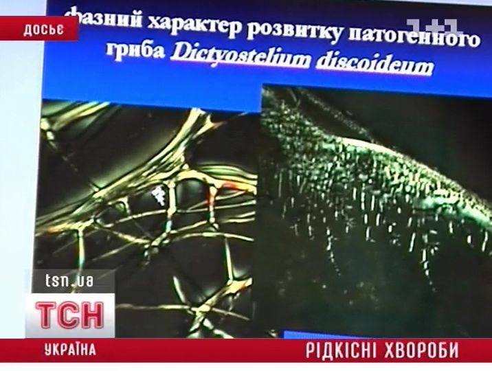 09_zabolev