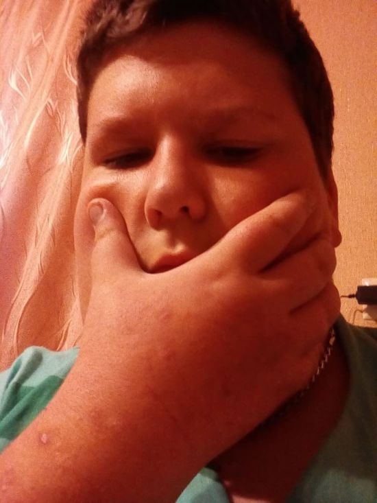 "Був єдиним сином у мами": у Чернігівській області від коронавірусу помер 15-річний підліток