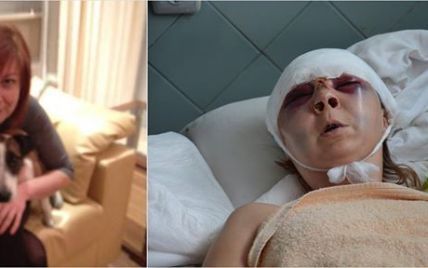В Киеве зверски избили активистку, которая боролась против застройщиков парка "Киото"