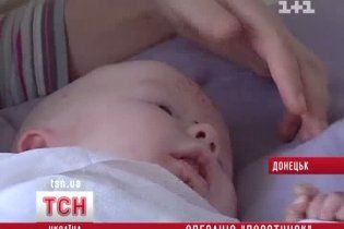 Українські лікарі подарували життя народженій без шкіри дитині