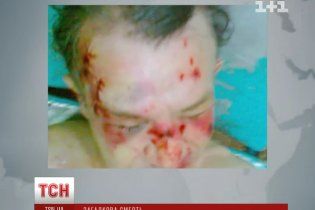 На Киевщине загадочно умер юрист, собравший компромат на чиновников