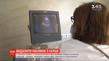 В Институте хирургии и трансплантологии Шалимова провели уникальную операцию на сердце