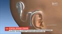 Кто отговаривает родителей детей с нарушением слуха от кохлеарной имплантации