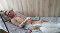 Колі потрібна наступна операція, на яку у мами юнака не вистачає коштів