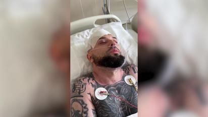 Дружина зірки "Ліги Сміху" Розового показала, який вигляд мав чоловік після операції на голові