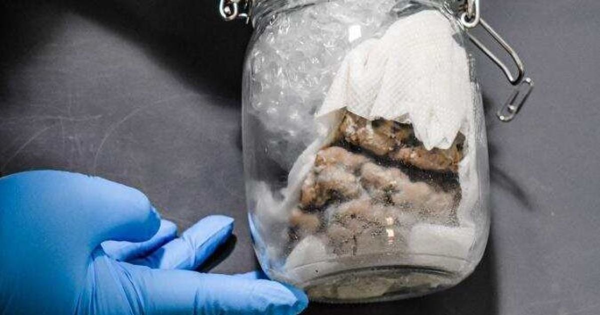 Из Канады в США по почте прислали человеческий мозг