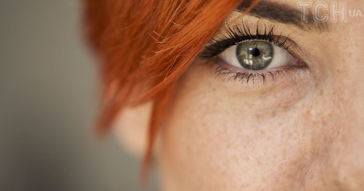 "Мушки" перед глазами