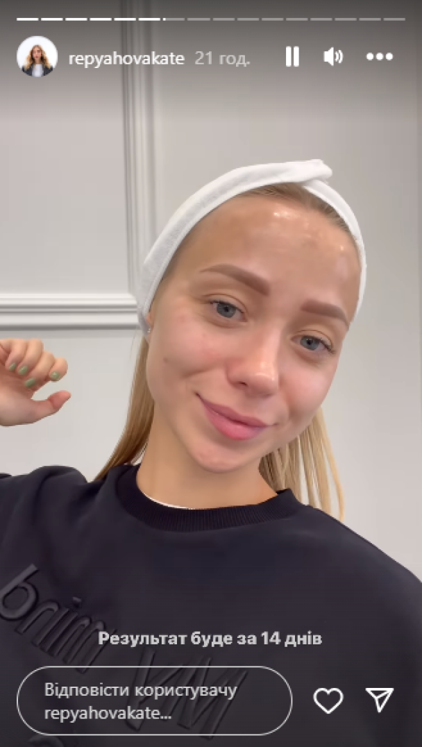 Екатерина Репяхова / © instagram.com/repyahovakate