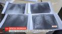 Троє людей померли через пневмонію у Тернополі  
