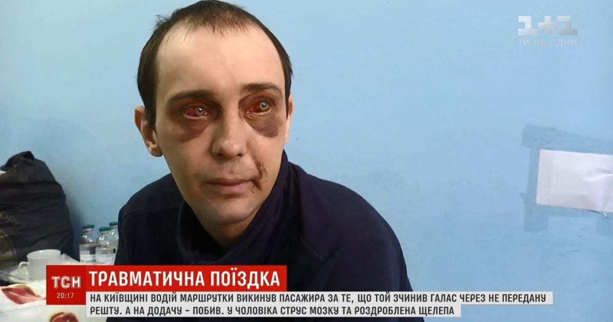 Открытая ЧМТ и тяжелый перелом челюсти: на Киевщине водитель маршрутки жестоко избил пассажира за 2 гривны