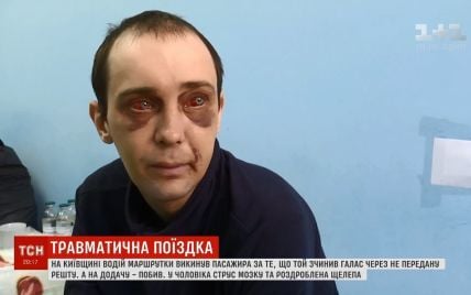 Відкрита ЧМТ і важкий перелом щелепи: на Київщині водій маршрутки жорстоко побив пасажира за 2 гривні