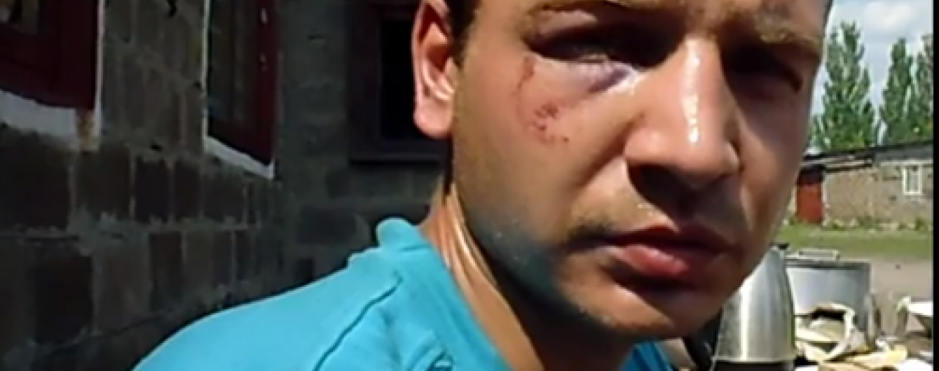 З полону звільнили бійця, якого бойовики змусили брехати про 200 загиблих у Мар'їнці