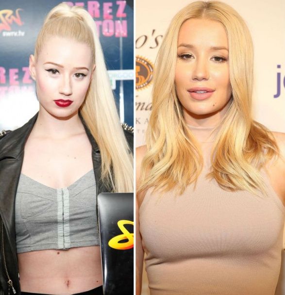 Игги Азалия / © Getty Images