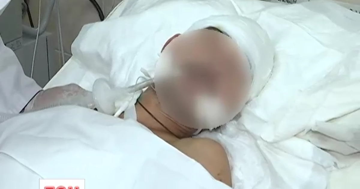 У зоні АТО поранено добровольця-батька вісьмох дітей