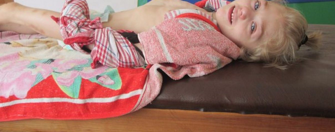 8-річна Вікторія з Донбасу потребує допомоги небайдужих