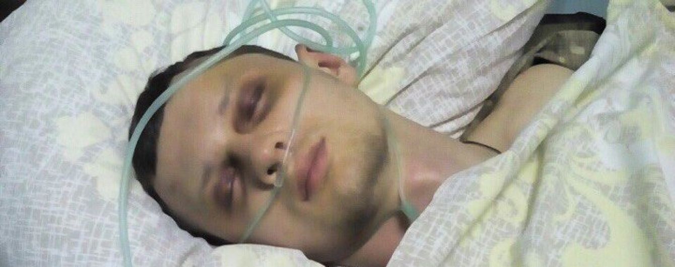 Адвокат розповів про черепно-мозкову травму у Краснова і охорону у лікарні