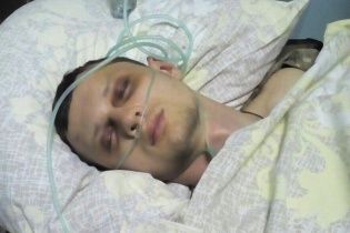 Адвокат розповів про черепно-мозкову травму у Краснова і охорону у лікарні