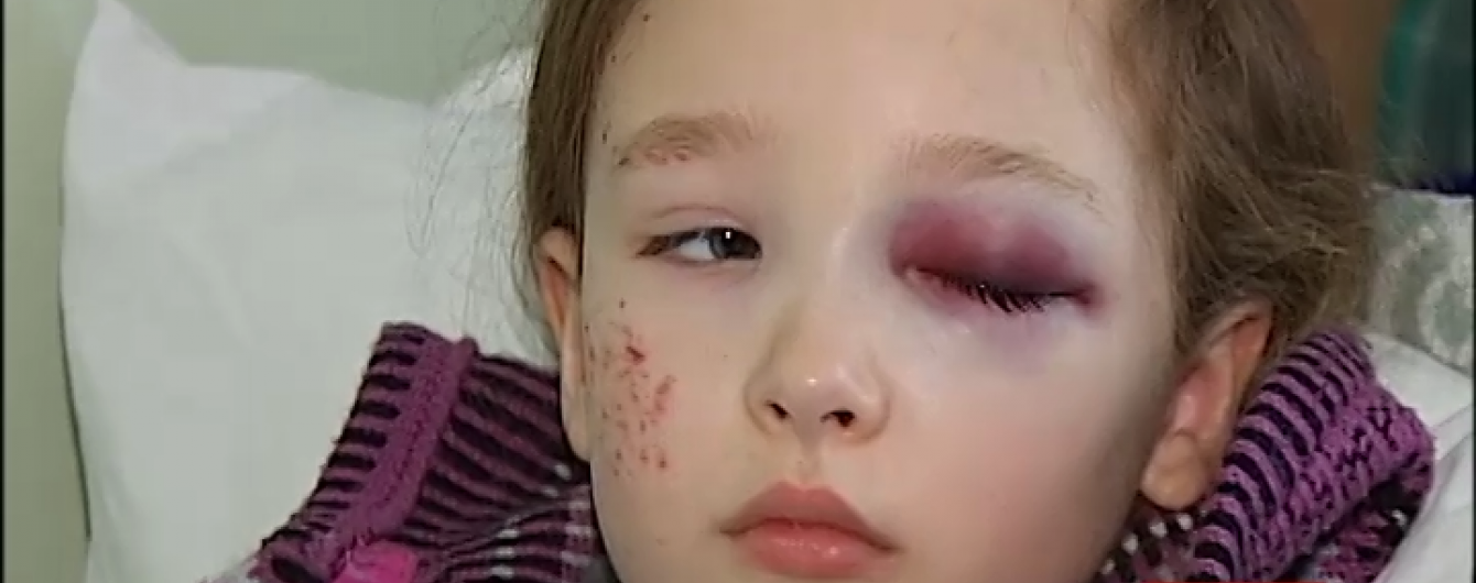 На Київщині через п'яного водія у ДТП постраждали 8 людей
