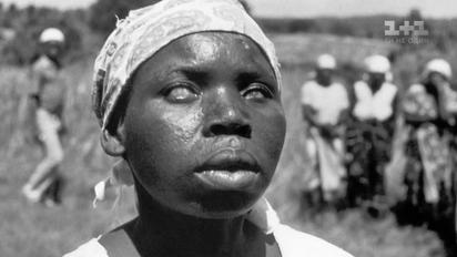 Чорна віспа: хвороба, що вбила десятки мільйонів людей