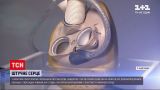 Новости мира: в Германии 58-летнему пациенту впервые пересадили искусственное сердце