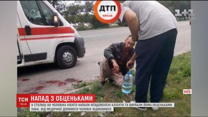 В Киеве заметили мужчину в крови и без половины нижней челюсти