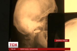 Моторошні подробиці поранення бійця АТО: куля снайпера заглибилася на 10 см у голову