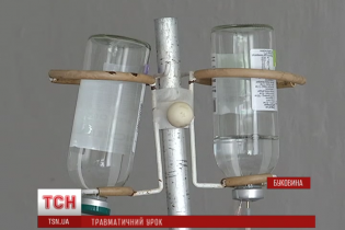 У Чернівцях 15-річний хлопець отримав важкі опіки під час "виробничої практики"