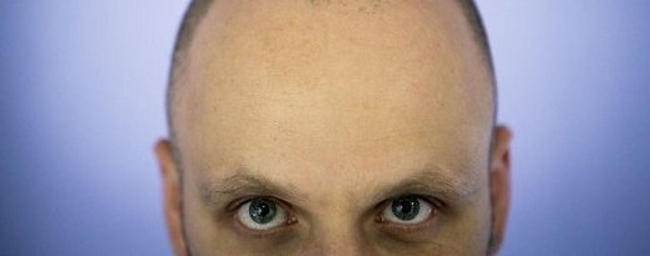День голомозих у Раді: як нардепи ставляться до тотальної втрати волосся