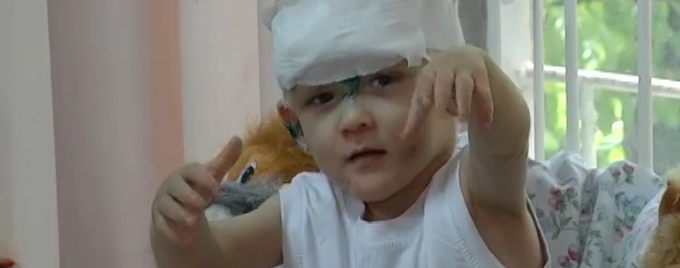 Побитому одеському хлопчику-знайді знадобиться пересадка шкіри