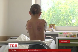 Названа матір відлупцювала до реанімації 9-річного хлопчика-сироту