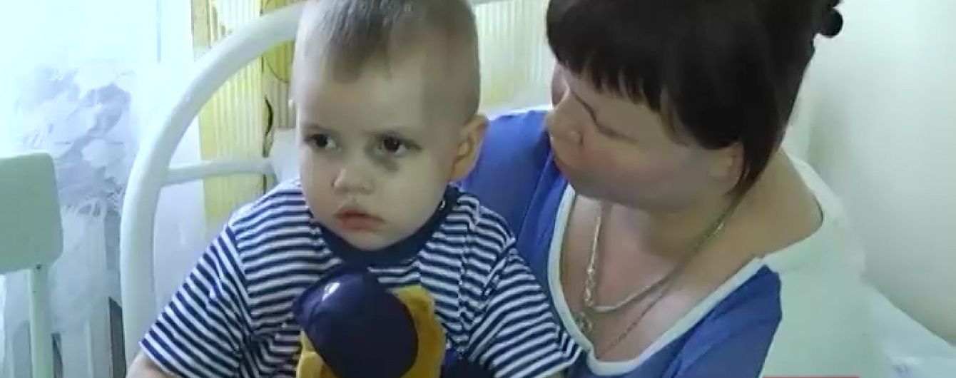 Українські медики врятували 2-річного хлопчика, який випав із вікна в Авдіївці