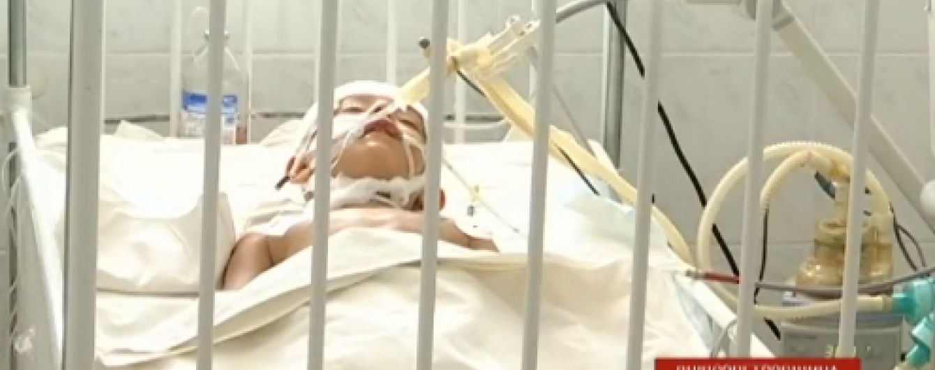 Дніпропетровські лікарі врятувати хлопчика, якому лезо з косарки проштрикнуло голову