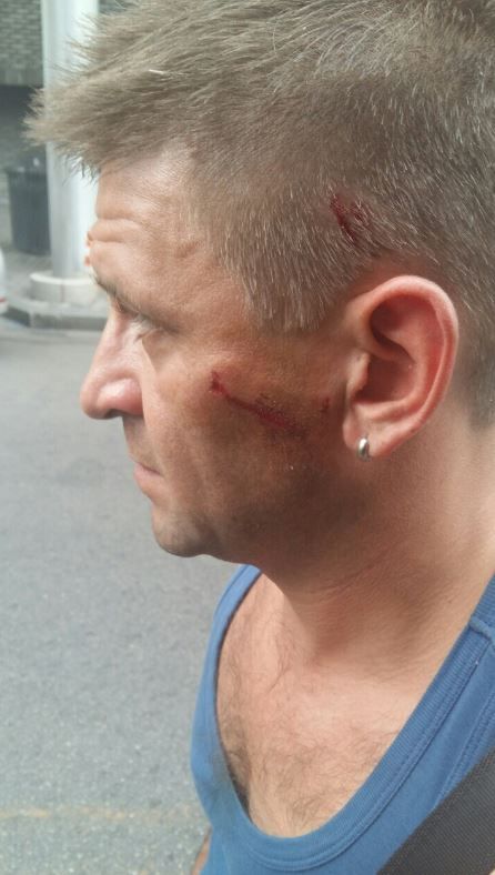 Побиття чоловіка Валевської 2_3