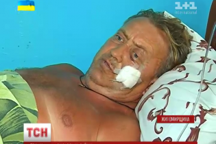 У Бердичеві 83-річна жінка стріляла у сусіда, щоб не пиляв дерева