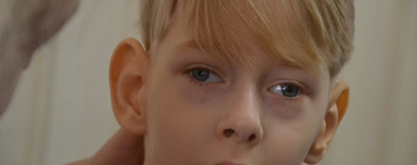 Допоможіть 5-річному Артурчику одужати