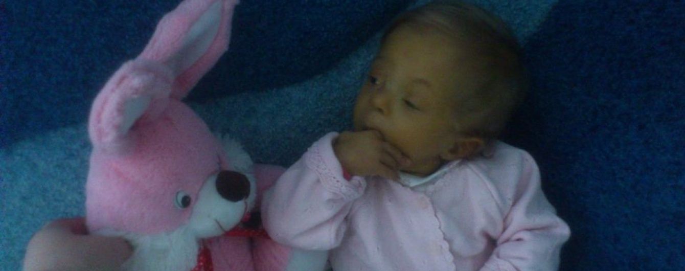 Пересадка печінки може врятувати життя крихітної Надійки