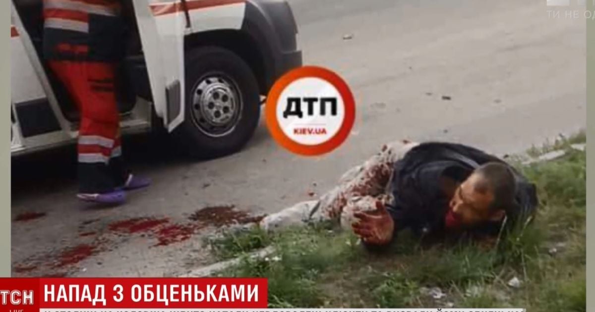 В Киеве на Кольцевой дороге нашли мужчину с оторванной челюстью