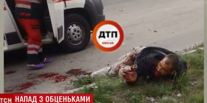 В Киеве на Кольцевой дороге нашли мужчину с оторванной челюстью