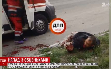 В Киеве на Кольцевой дороге нашли мужчину с оторванной челюстью