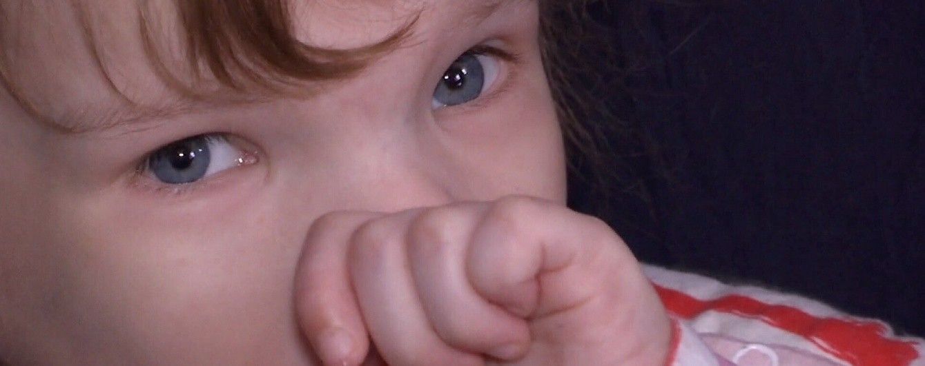 Дівчинка-дюймовочка Настя з Чернігівщини потребує допомоги
